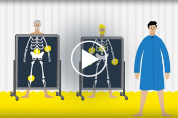 Anti-fatigue Dave Image for video explainer